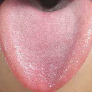 Обриви в езика и тялото: причини