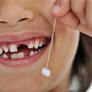 Дали е ужасна промяна на зъбите при дете, както мислят родителите?