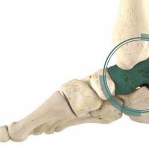 Травматология на крака: анатомия и травма