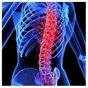 Увреждания на гръбнака: класификация, симптоми, лечение