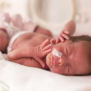 Грижа за недоносени бебета в болницата и след освобождаване от отговорност
