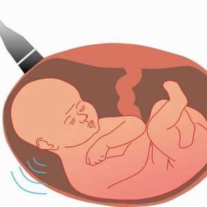 Ултразвуково проучване за скрининг. Проверка за бременност