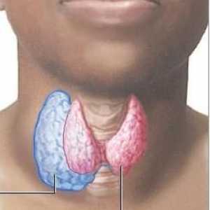 Нодуларен удар на щитовидната жлеза: причини, симптоми и методи на лечение