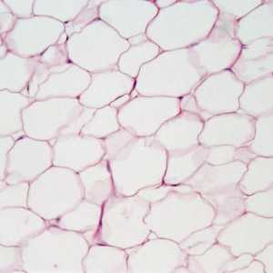 Видове епителна тъкан. Епителни тъкани: структура и функция