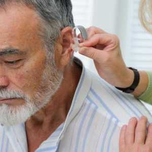 Интраканален слухов апарат: описание, видове, функции и прегледи