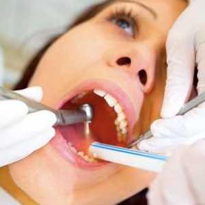 Зъб мъдрост да се лекува или да се премахне? Извличане на зъби от мъдрост