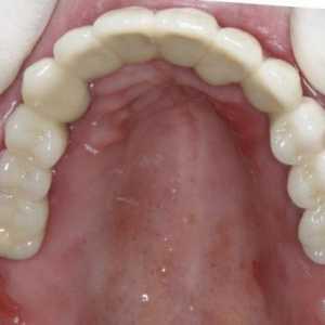 "Dentures`Akri-Free": описание, предимства и недостатъци, прегледи на стоматолозите